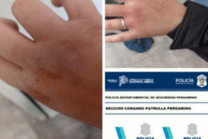 Pergamino – Sujeto exaltado mordió a dos personas y fue aprehendido